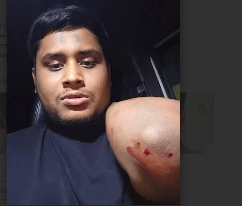 এনসিপি নেতা হাসনাত আবদুল্লাহর উপর সন্ত্রাসী হামলায় ইনকিলাব মঞ্চ কুমিল্লার নিন্দা ও প্রতিবাদ